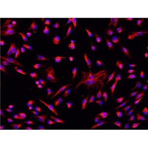 大鼠心肌成纤维细胞