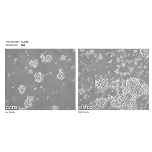 Raji细胞 P1-Raji细胞 GM04671细胞ATCC CCL-86标准Burkitt's
