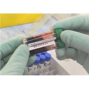 Caspase-6 Antibody 生产供应商艾普蒂生物
