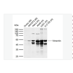Anti-Vimentin antibody  -波形蛋白抗体
