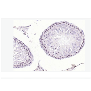 Anti-CDK6 antibody-周期素依赖性激酶6抗体