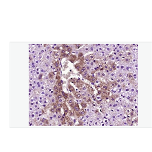 Anti-TTR/Prealbumin antibody-转甲状腺素蛋白/前白蛋白抗体