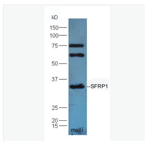 Anti-SFRP1 antibody-分泌型卷曲相关蛋白1抗体