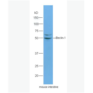Anti-Beclin 1 antibody-自噬效应蛋白Beclin 1抗体