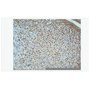 Anti-Ki-67 antibody -Ki67蛋白抗体