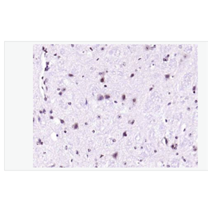 Anti-phospho-IRS1 antibody-磷酸化胰岛素受体底物-1抗体