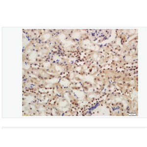 Anti-Phospho-IRAK1 (Ser376) antibody-磷酸化白介素-1受体相关激酶1抗体