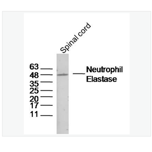 Anti-Neutrophil Elastase antibody-中性粒细胞弹性蛋白酶ELANE抗体