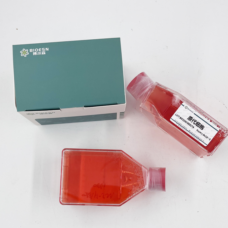 Human外核苷酸焦磷酸酶/磷酸二酯酶2(ENPP2) ELISA Kit