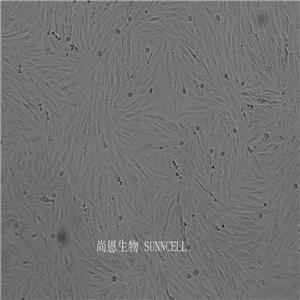 SF126人胶质母细胞瘤细胞