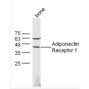 Adiponectin Receptor 1 脂联素受体1抗体
