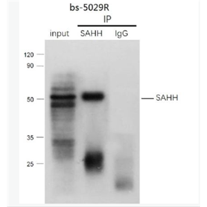 Anti-SAHH antibody -S腺苷L-同型半胱氨酸水解酶抗体