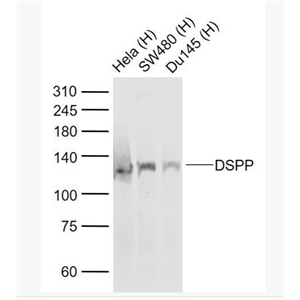 Anti-DSPP antibody-牙本质磷蛋白抗体