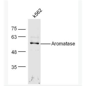 Anti-Aromatase antibody-芳香化酶/细胞色素P450/雌激素合成酶抗体