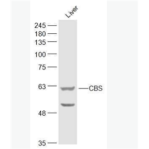 Anti-CBS antibody-丝氨酸羧甲半胱氨酸合成酶抗体