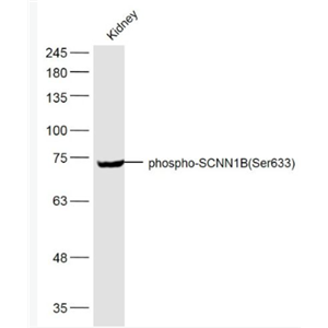 Anti-phospho-SCNN1B (Ser633) antibody-磷酸化上皮钠通β抗体