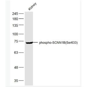 Anti-phospho-SCNN1B (Ser633) antibody-磷酸化上皮钠通β抗体.