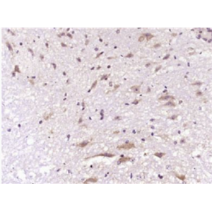 Anti-Neutrophil Elastase  antibody-中性粒细胞弹性蛋白酶ELANE抗体