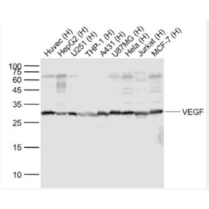 Anti-VEGF antibody-血管内皮生长因子抗体