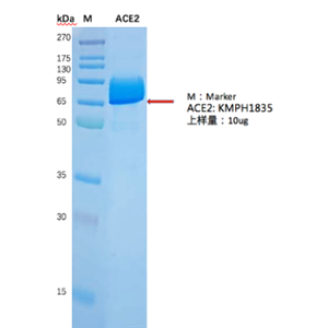 Recombinant Human ACE2 Protein, His Tag