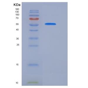 Recombinant Rat BCAM Protein (His tag)