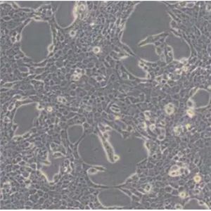 MKN-7细胞（人胃癌细胞）