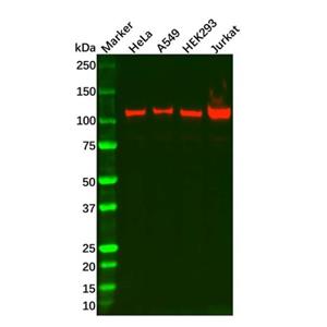 aladdin 阿拉丁 Ab125359 ecombinant RIG-I/DDX58 Antibody Recombinant (R04-8J4); Rabbit anti Human RIG-I Antibody; WB; Unconjugated