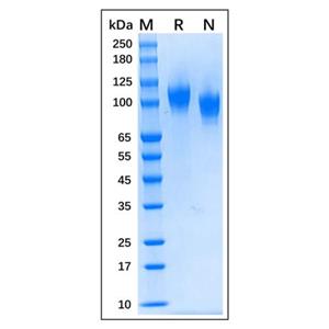 aladdin 阿拉丁 rp175917 Recombinant Human NCAM-1/CD56 Protein Animal Free, >90% SDS-PAGE, CHO, C-His tag, 20-603 aa