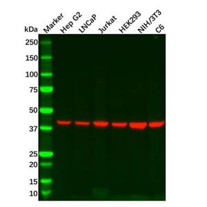 aladdin 阿拉丁 Ab109665 Recombinant Ihh Antibody Recombinant (R03-3F2); Rabbit anti Human Ihh Antibody; WB, IHC; Unconjugated