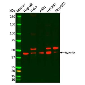 aladdin 阿拉丁 Ab134773 Recombinant Wnt5b Antibody Recombinant (R03-7C4); Rabbit anti Human Wnt5b Antibody; WB; Unconjugated