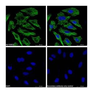 aladdin 阿拉丁 rp155876 Streptavidin protein (FITC) Streptavidin was conjugated with FITC under optimum conditions, and unconjugated Streptavidin and free FITC were removed.