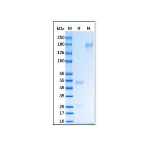 aladdin 阿拉丁 Ab175962 Pig IgG ≥ 95%; Isotype Control Antibody; Pig IgG; Unconjugated