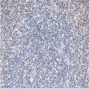 人子宫内膜腺癌细胞HEC1A