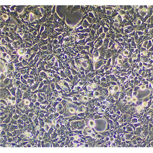 小鼠胰岛内皮细胞MS1