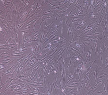 骨髓间充质.png 骨髓间充质.png