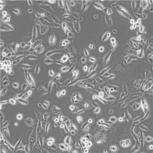 HCT-116 Cells#人结肠癌细胞系低代次|培养基|赠STR图谱