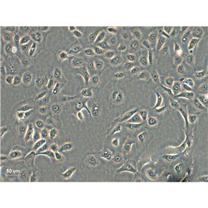 U-937人组织细胞淋巴瘤复苏细胞|送STR报告