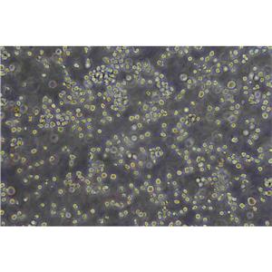 EoL-1 Cells人细胞|仅提供STR图谱