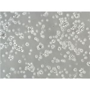 211-LCL Cells人细胞|仅提供STR图谱