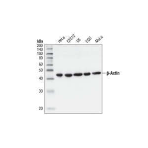 BETA ACTIN抗体