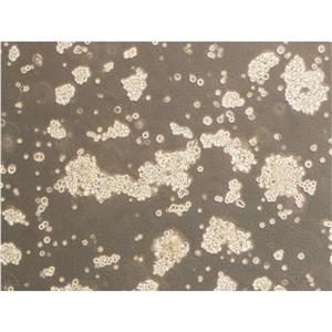 NCI-H226 Cells人肺鳞癌细胞传代培养|STR图谱