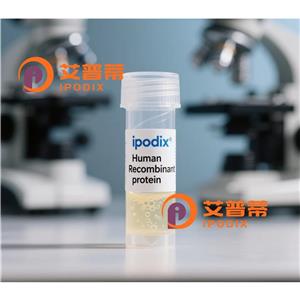 Rabbit Polyclonal SLC2A11 Antibody