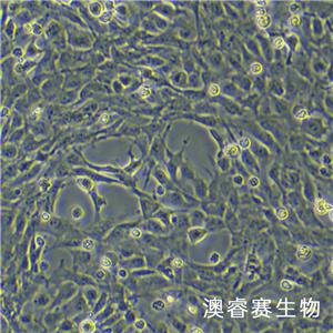 12Z（人源子宫内膜异位细胞）