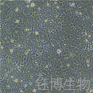 HCC827（人非小细胞肺癌细胞）YB-71094HC