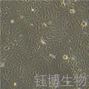 HCC1937（人乳腺癌细胞）YB-71093HC