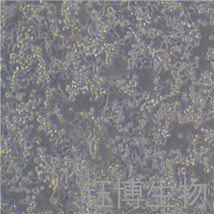 HCT 116（人结肠癌细胞）YB-71096HC