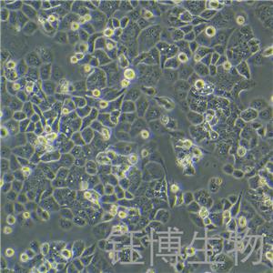 HEC-1-A（人子宫内膜腺癌细胞）YB-71099HC