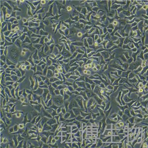 HEp-2（人喉表皮样癌细胞）YB-71104HC