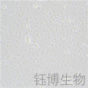 Hep 3B2.1-7（人肝癌细胞）YB-71102HC