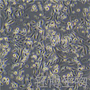 HFL1（人胚肺成纤维细胞）YB-71106HC